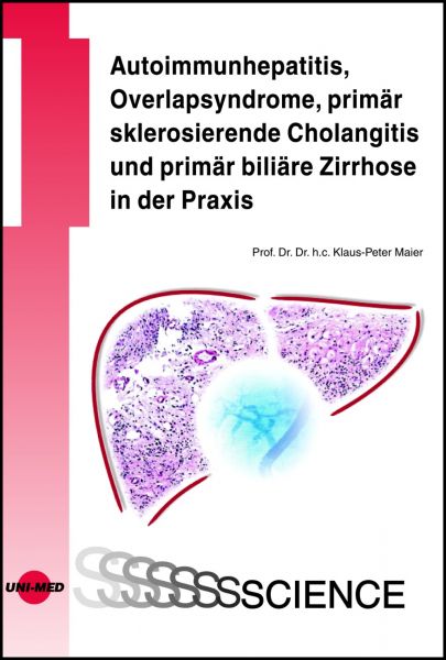 Autoimmunhepatitis, Overlapsyndrome, primär sklerosierende Cholangitis und primär biliäre Zirrhose i