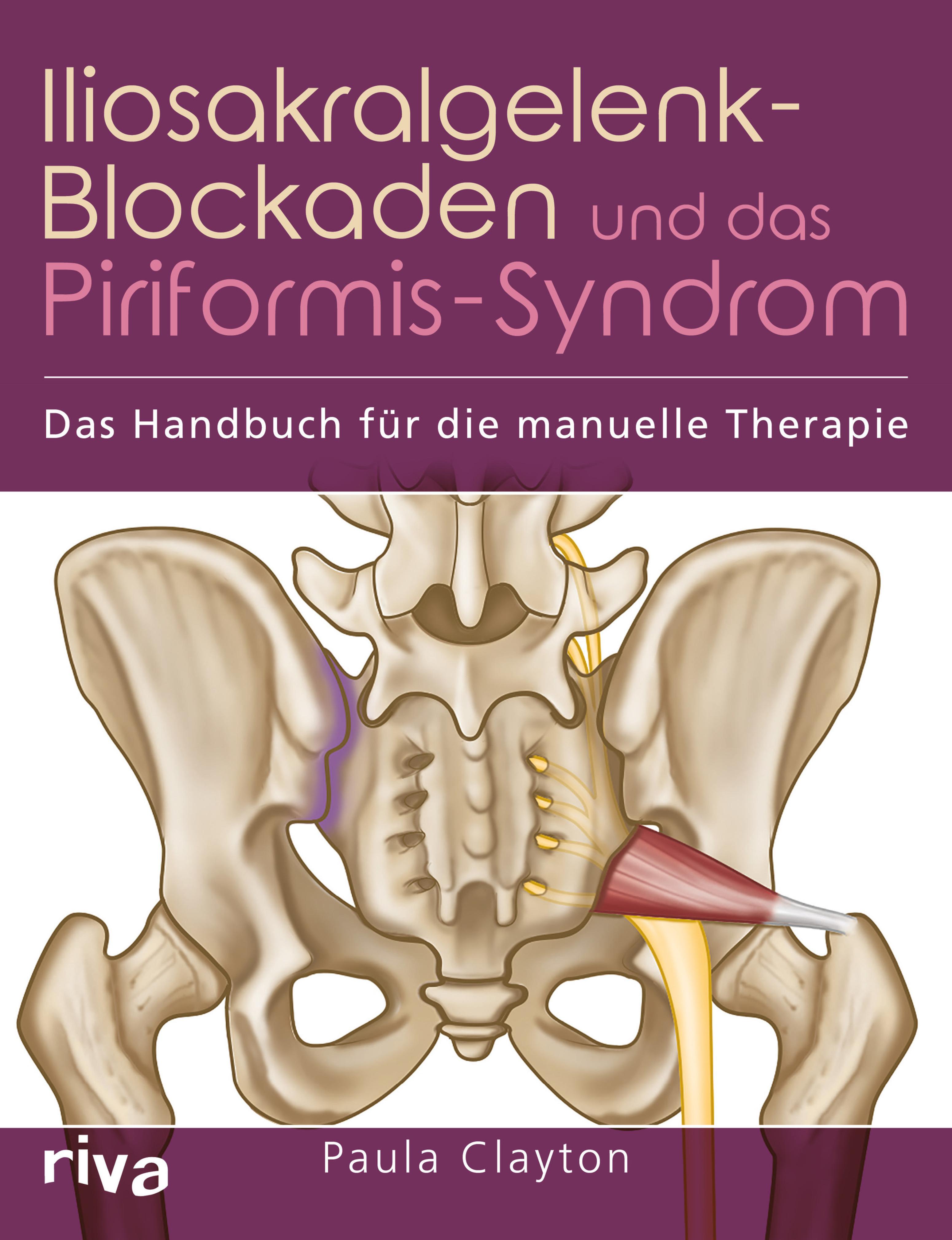 Iliosakralgelenk Pferd übungen Zum Lösen Von Blockaden Iliosakralgelenk-Blockaden und das Piriformis-Syndrom (, - Riva)