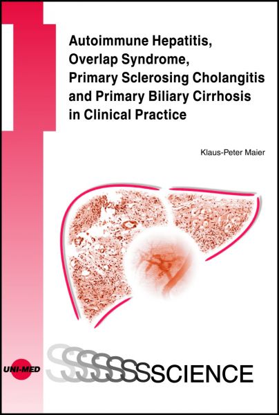 Autoimmune Hepatitis, Overlap Syndrome, Primary Sclerosing Cholangitis and Primary Biliary Cirrhosis