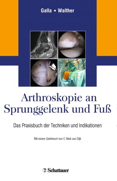 Arthroskopie an Sprunggelenk und Fuß