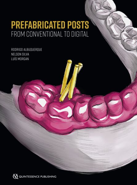 Prefabricated Posts