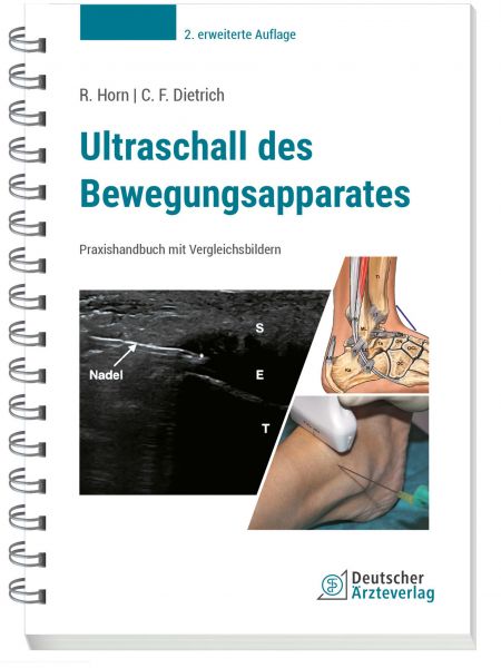 Ultraschall des Bewegungsapparates