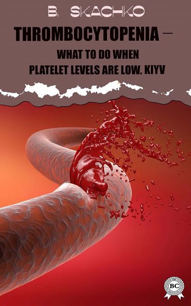 Thrombocytopenia – What to Do When Platelet Levels Are Low. Kiyv