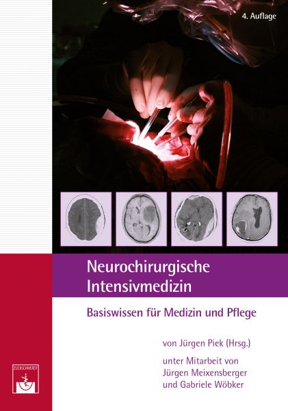 Neurochirurgische ﻿Intensivmedizin